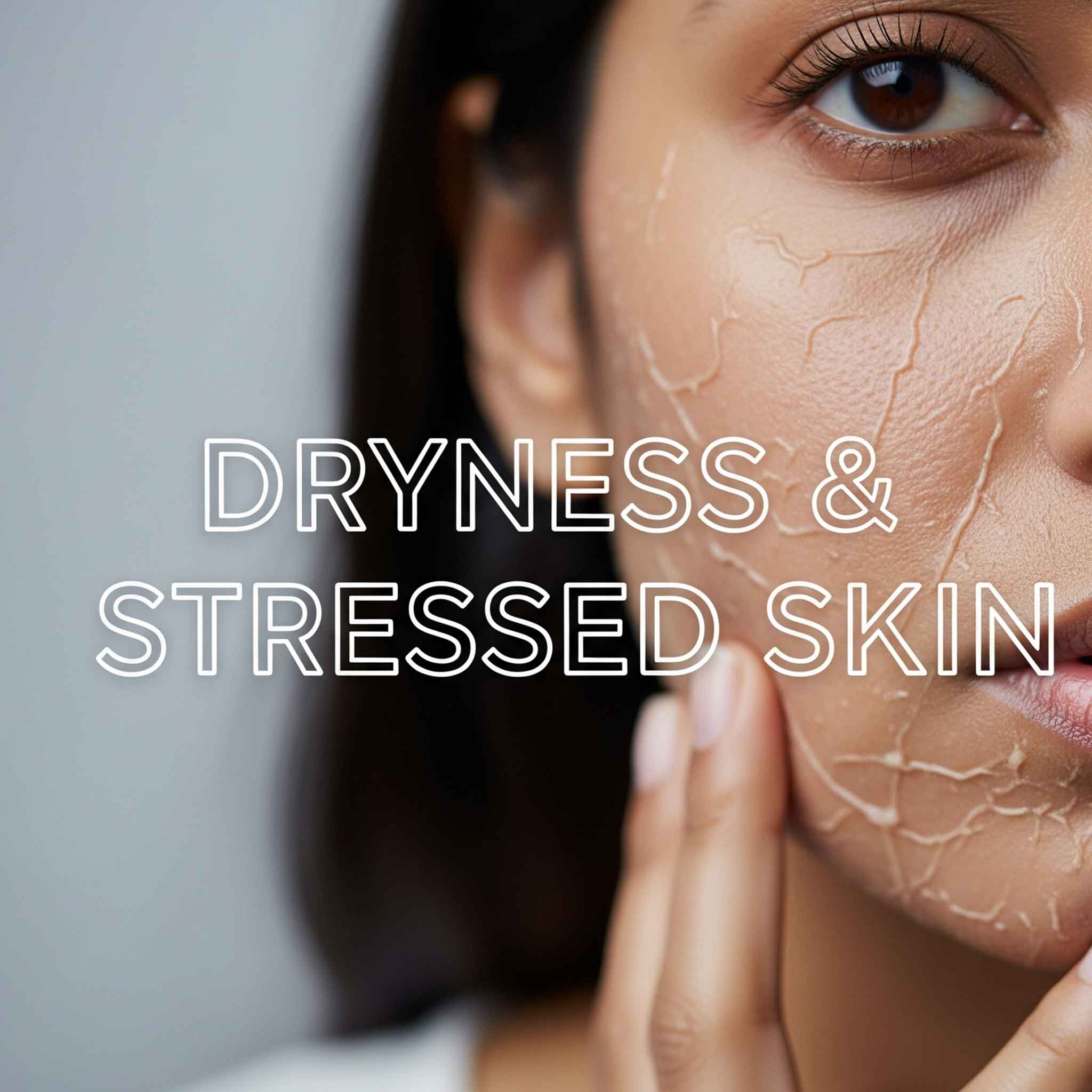 Dryness & Stressed Skin