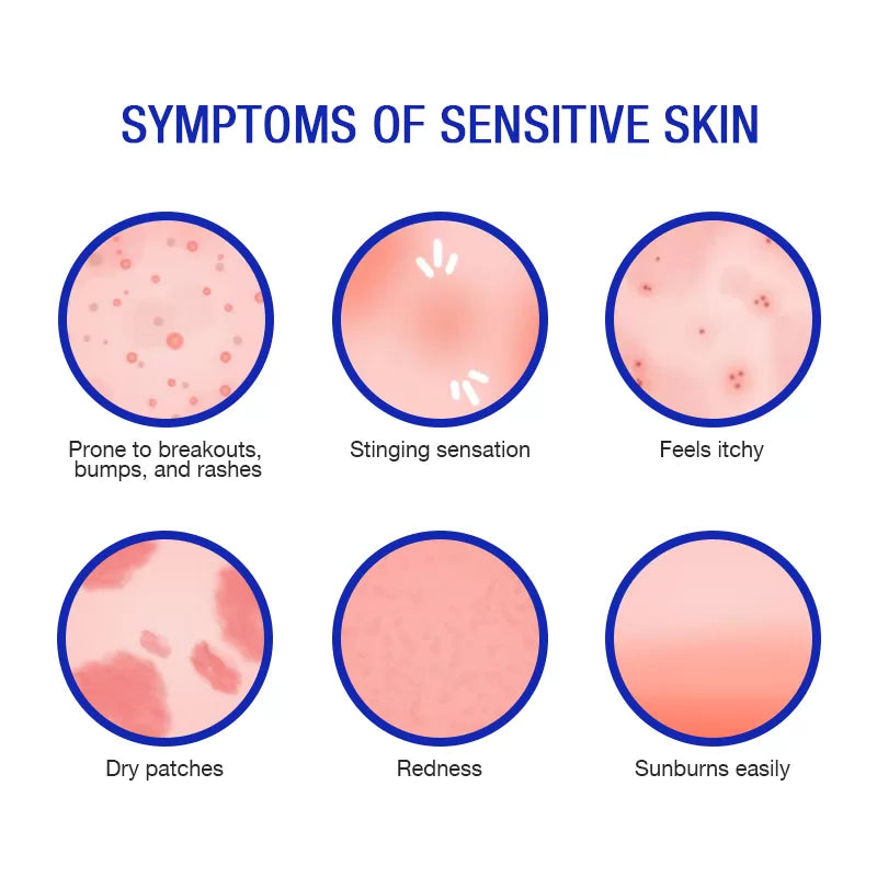 Sensitive Skin