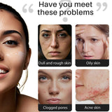 Salicylic Acid Soap for Acne & Oily Skin | Anti-Acne Face & Body Cleanser - Glam & Curious