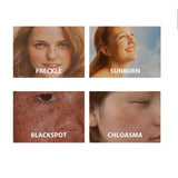 Niacinamide Serum best for Dark Spot Remove, Anti-aging, Bright Freckle, Whiten Serum - Glam & Curious