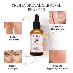 Vitamin C Serum for Brightening & Firming Serum with Hyaluronic Acid – 10% Vitamin C Hydrates & Revives Dull Skin