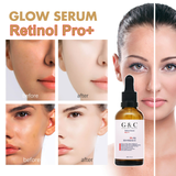 Retinol Brightening Serum – Dark Spot, Wrinkle & Pigmentation Treatment - Glam & Curious