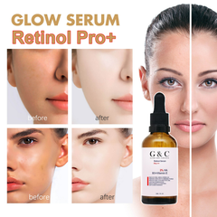 Retinol Brightening Serum – Dark Spot, Wrinkle & Pigmentation Treatment - Glam & Curious