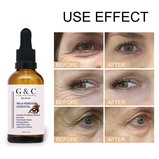 Glam & Curious | Milia Removal Essential Eye Serum