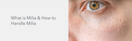 What is Milia & How to Handle Milia ?
