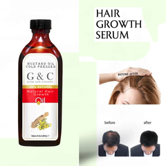 Natural Hair Growth Products Organic Anti Hair Loss Baldness Treatment Herbal Hair Regrowth Oil for Man and Women