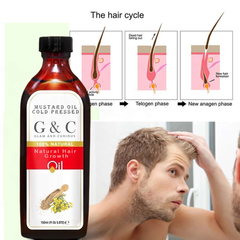 Natural Hair Growth Products Organic Anti Hair Loss Baldness Treatment Herbal Hair Regrowth Oil for Man and Women