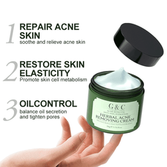 Acne Face Cream Body Pimple Treatment Oil Control Moisturizing Facial Creams Skin Care Products Beauty