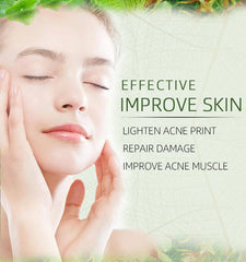 Acne Face Cream Body Pimple Treatment Oil Control Moisturizing Facial Creams Skin Care Products Beauty