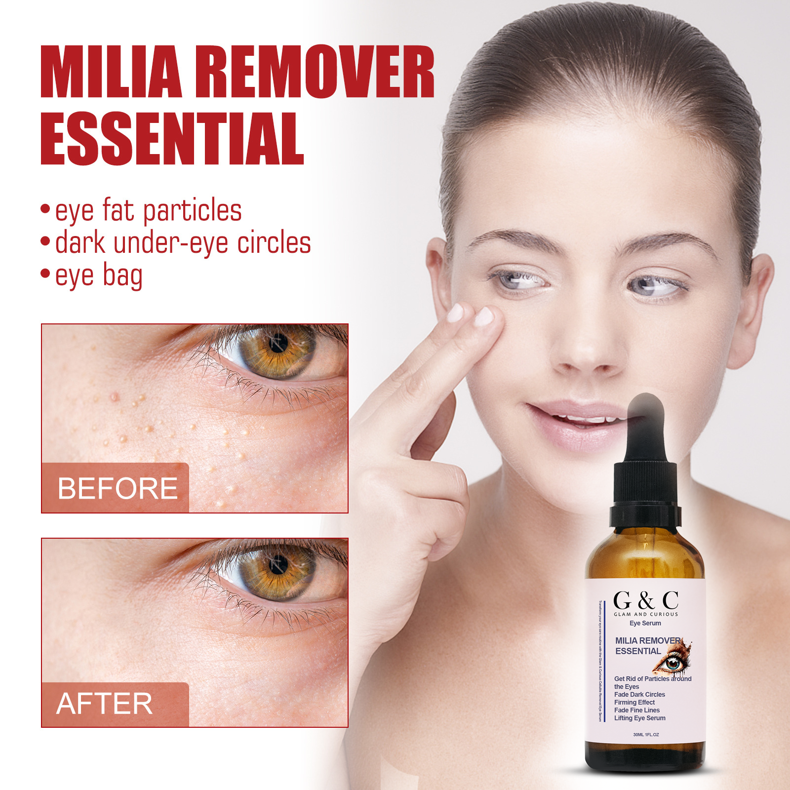Milia Removal Essential Eye Serum Get rid of particles around the eyes, Fade dark circles Firming Fade fine lines Lifting Eye Serum