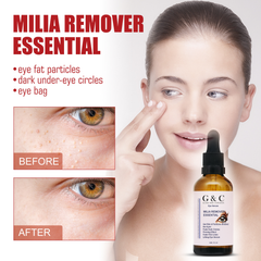 Milia Removal Essential Eye Serum Get rid of particles around the eyes, Fade dark circles Firming Fade fine lines Lifting Eye Serum - Glam & Curious