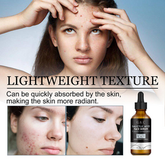 Salicylic Acid Serum for Anti Acne Face Serum, Acne Treatment, Repair dark Spots Scar Moisturizing, Oil Control Shrink