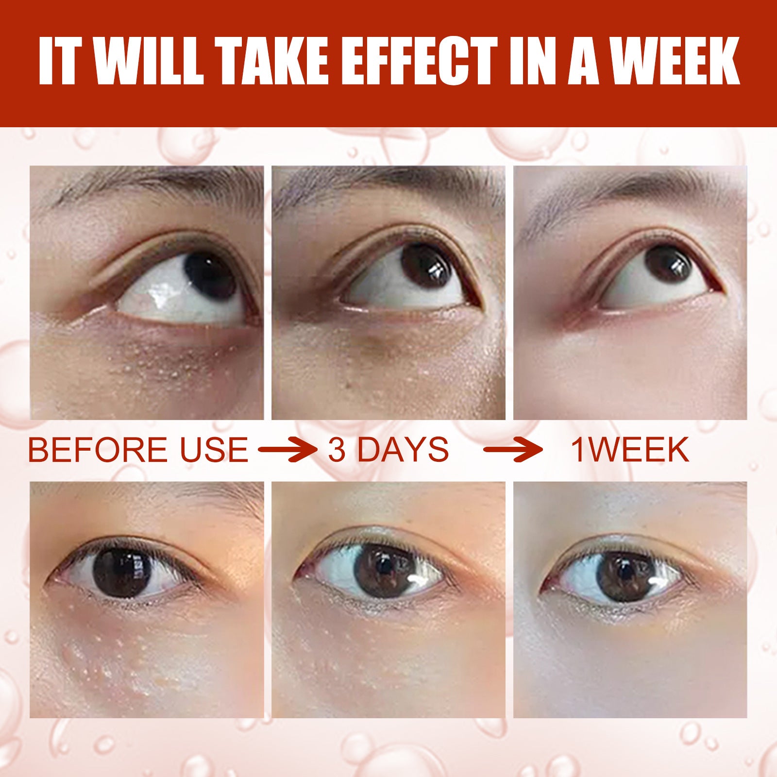 Milia Removal Essential Eye Serum Get rid of particles around the eyes, Fade dark circles Firming Fade fine lines Lifting Eye Serum