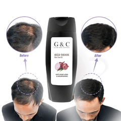 Onion anti hair fall  shampoo, wow red onion black seed oil shampoo