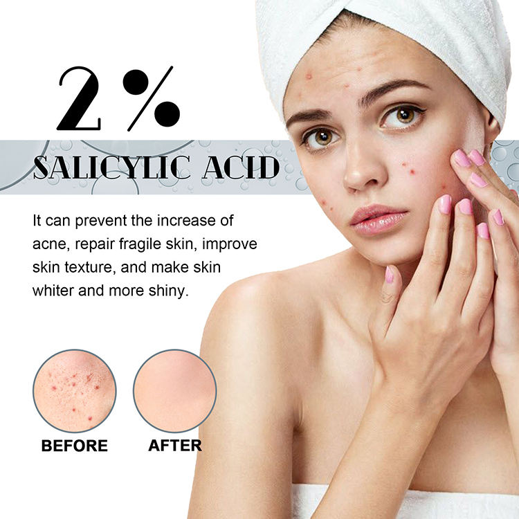 Salicylic Acid Acne Serum – Dark Spot Repair, Oil Control & Moisturizing - Glam & Curious