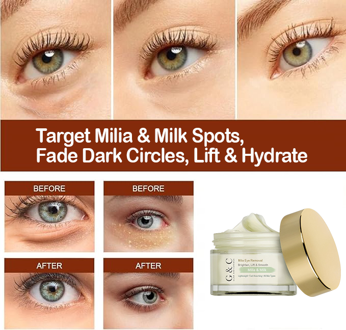 Milia & Milk Spots Remover Eye Cream | Dark Circles Lightening, Fine Lines Smoothing, Lifting & Moisturizing Eye Serum – For All Skin Types, Anti-Aging & Milia Treatment | Glam & Curious - Glam & Curious