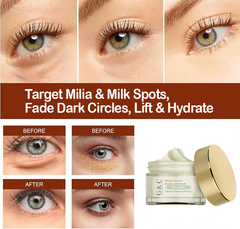 Milia & Milk Spots Remover Eye Cream | Dark Circles Lightening, Fine Lines Smoothing, Lifting & Moisturizing Eye Serum – For All Skin Types, Anti-Aging & Milia Treatment | Glam & Curious - Glam & Curious