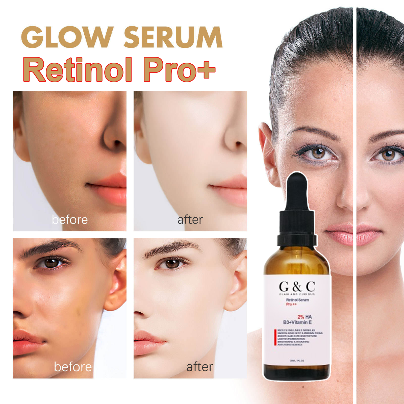 Retinol Brightening Serum – Dark Spot, Wrinkle & Pigmentation Treatment